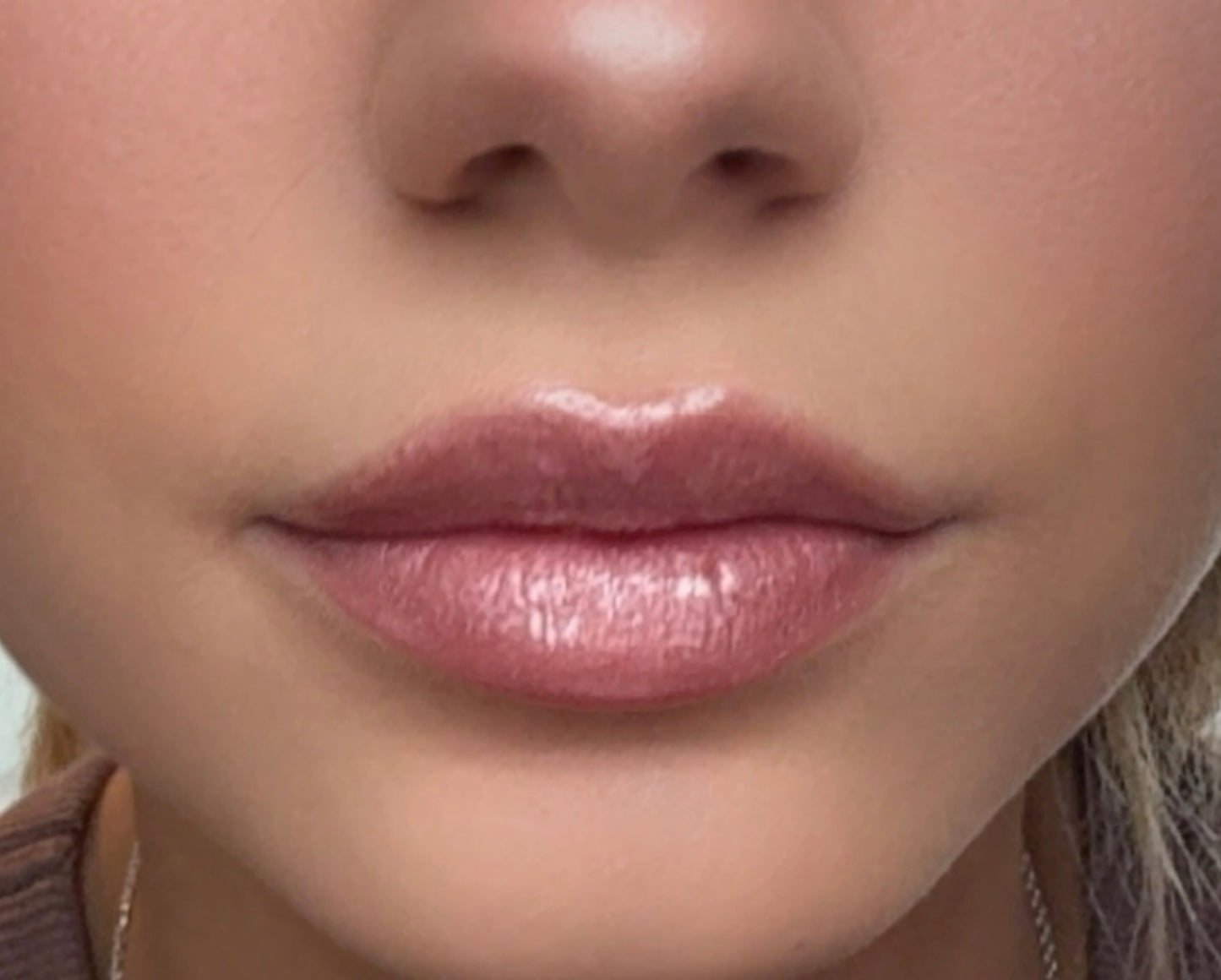 Bare LipFix